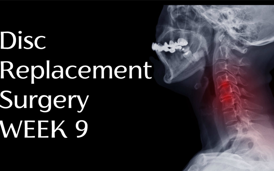 Dr Dave Perna Cervical Disc Replacement Surgery Week 9
